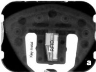 here is the inside of  key 2010 RTS SE5 dental xray.jpg