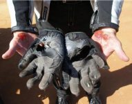 Injured Hands.jpg