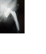 hip 1.jpg