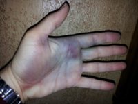 crushedHand.jpg
