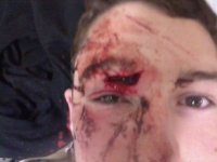 7stitches.jpg